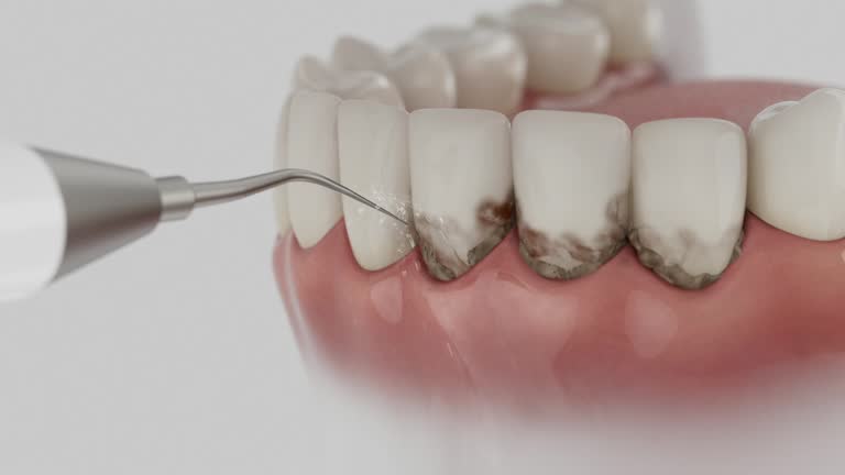 Trusted Emergency Dentist service in Bossier City, LA - Dentist Open Now